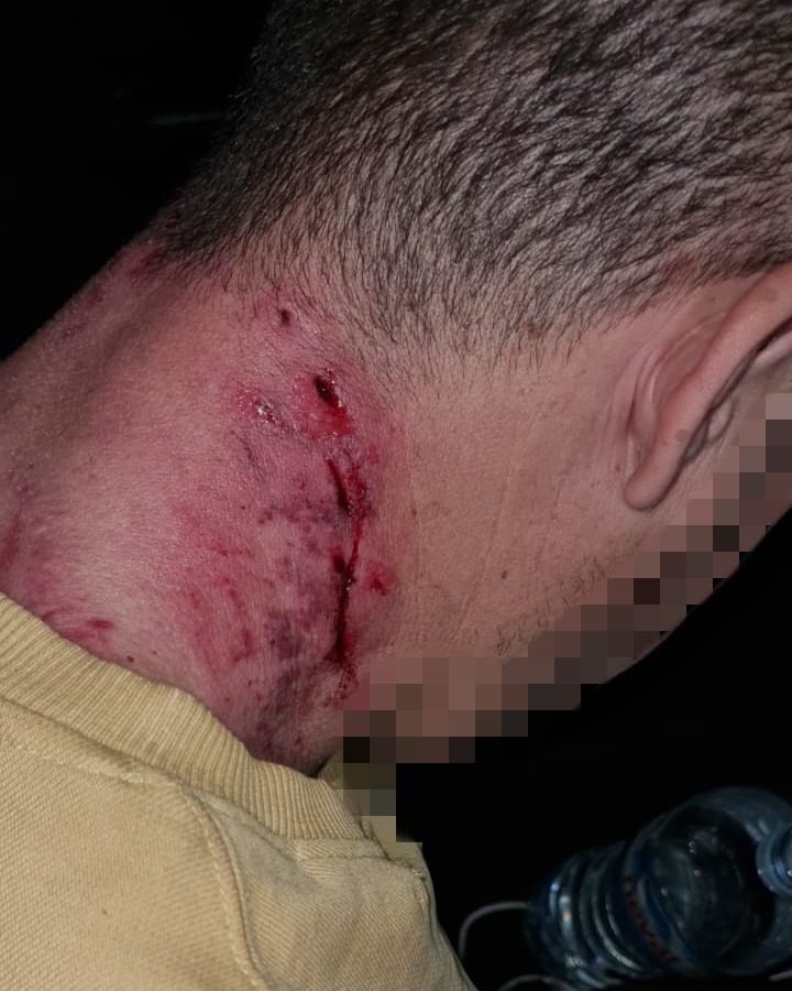  Un perro potencialmente peligroso ataca a un hombre en Jaén capital 